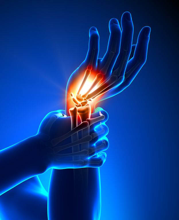 Carpal Tunnel Surgery South Arkansas Orthopaedics & Sports Medicine